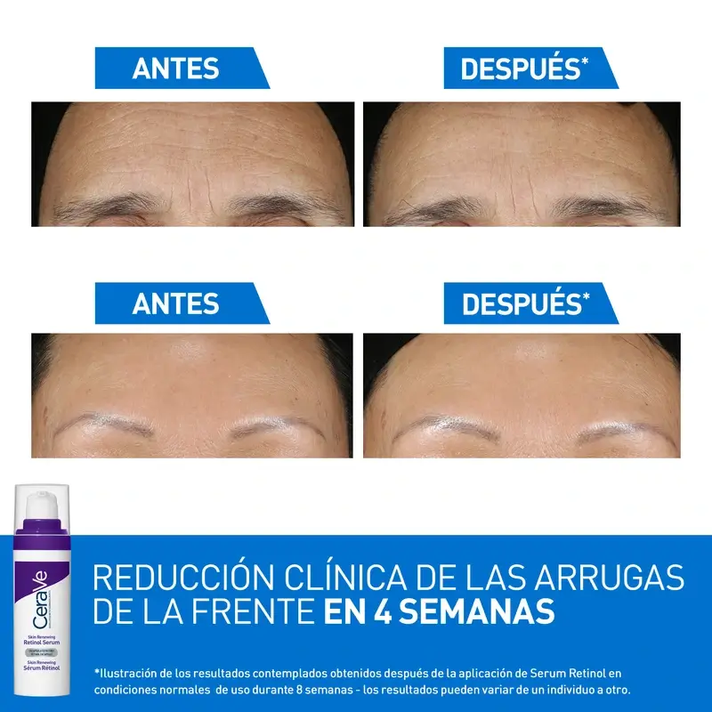 Cerave Skin Renewing Anti-Aging Retinol Serum, 30 ml - Image 9