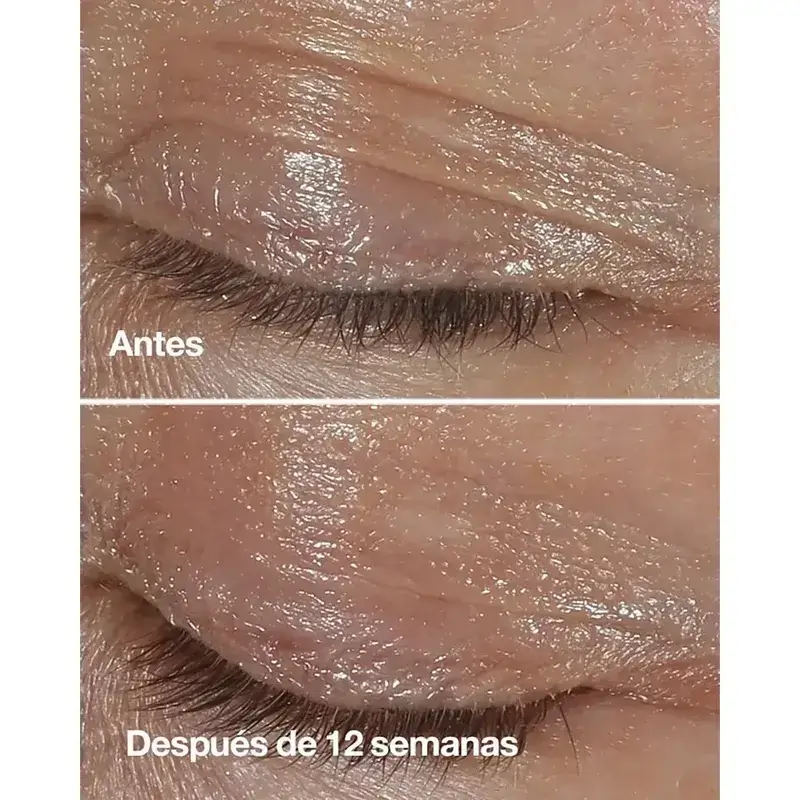 Clinique Smart Clinical Repair Anti-Wrinkle Correcting Eye Cream, 3x15 ml - Image 3