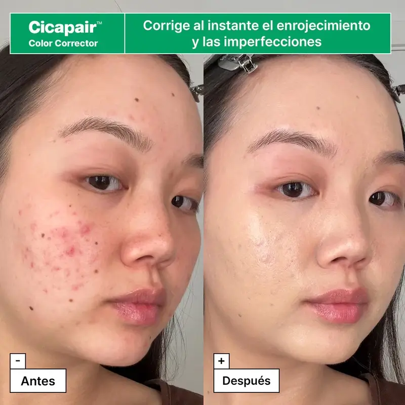 Dr.Jart+ Reddened Skin Rescue Kit with Centella asiatica - Image 5