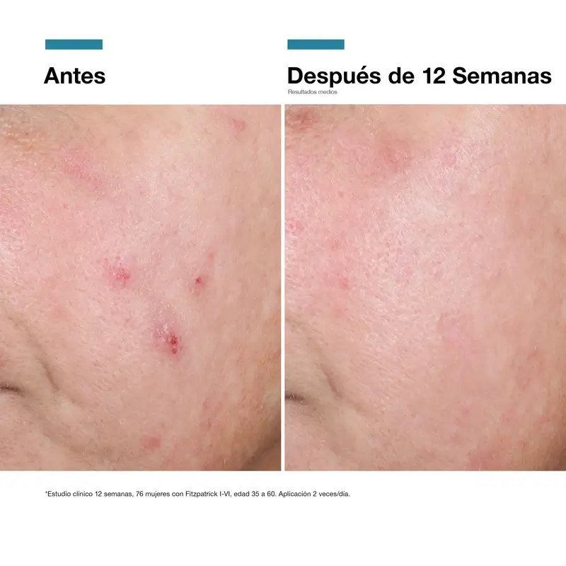 Skinceuticals Advanced Rgn-6, 50 ml - Image 13